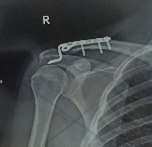 Астрологи объявили месяц без секса.