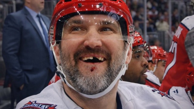 Овечкину в матче с "Чикаго" разбили лицо и сломали зуб