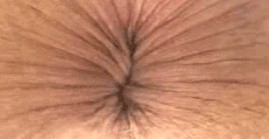 Хирург устроил фотосессию ануса россиянки под наркозом