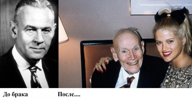 Стало известно, как брак влияет на продолжительность жизни мужчины в России