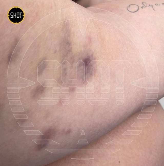 Две российские туристки не могут вернуться из отпуска в Турции уже полтора месяца