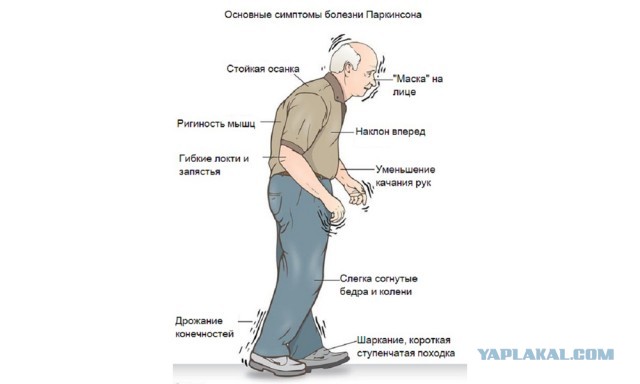 Здоровья мужику, не знаю эта хрень работает или нет...