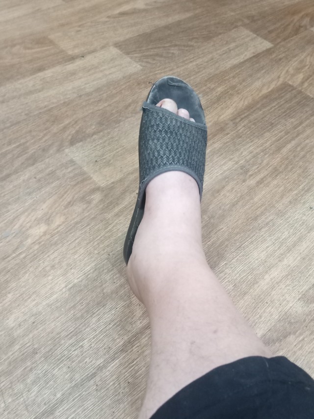 Ну вот и перелом