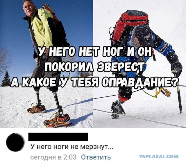 Жизнь без ноги - есть ли позитивные моменты?