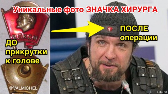 Хирург призвал россиян отказаться от автомобилей