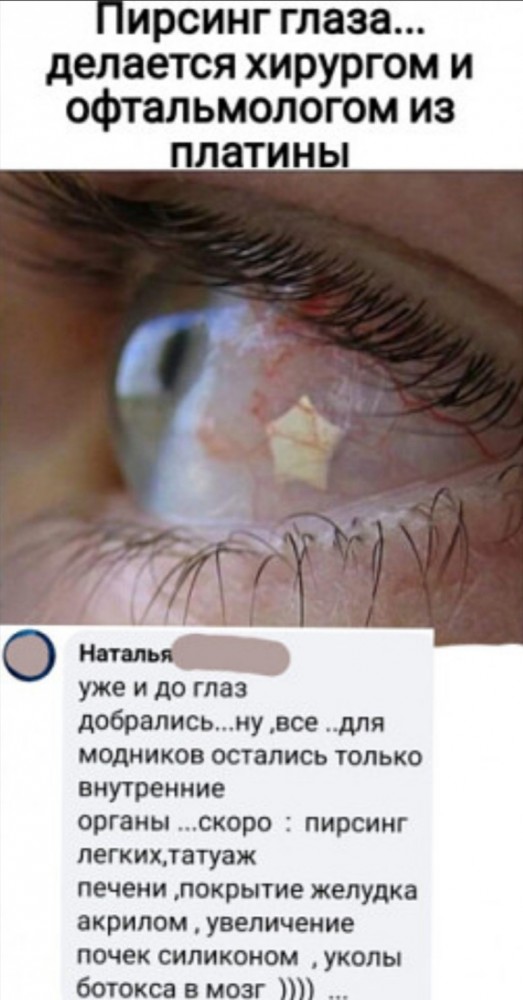 Бредзона 28.01.2021