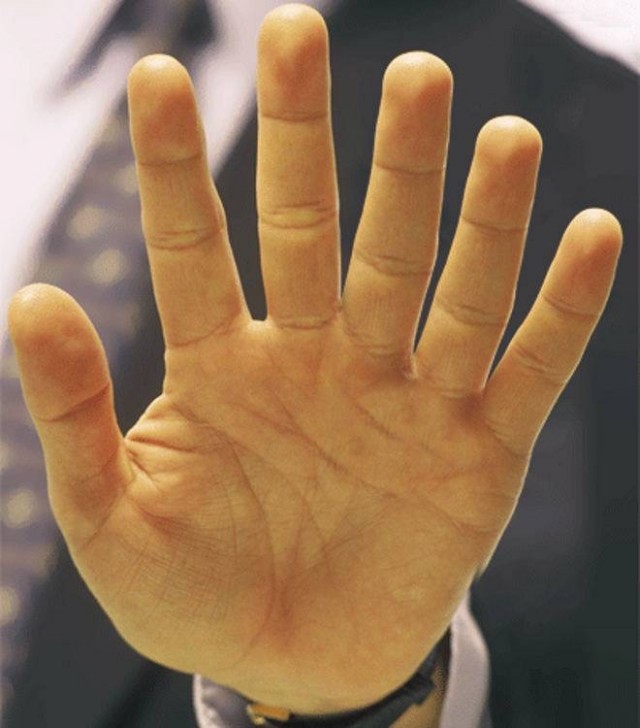 Вдогонку теме, которая в золоте