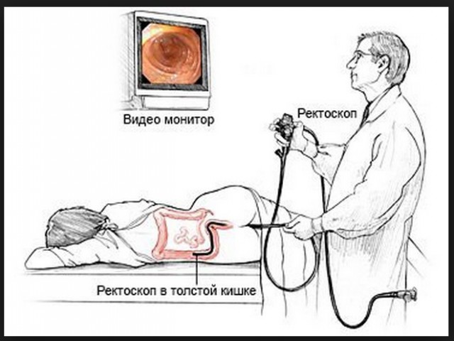 Про посещение проктолога