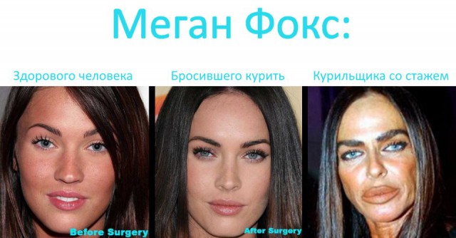 10 худших пластических операций знаменитостей