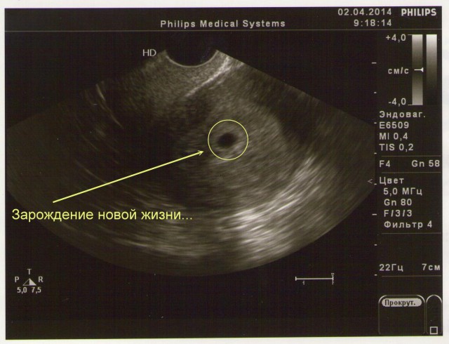 Зарождение новой жизни.