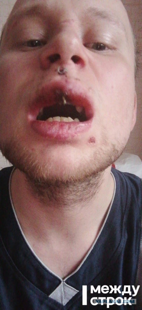 Новое развлечение подростков. Ходят толпой,пристают и избивают. И еще знают - им скорее всего ничего не будет.