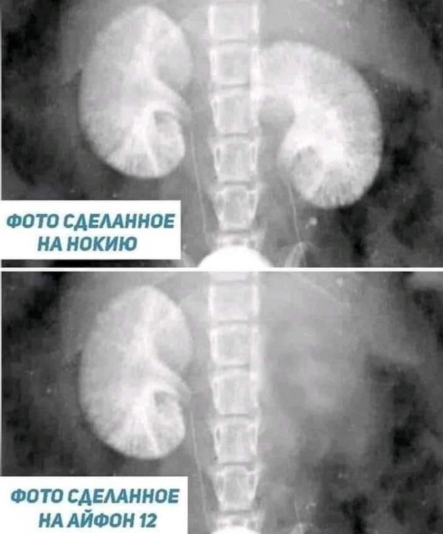 Бредзона 31.01.21