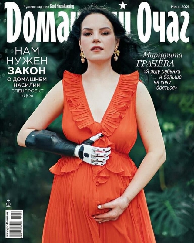 Маргарита Грачёва, которой муж из ревности отрубил кисти рук, снялась для обложки журнала