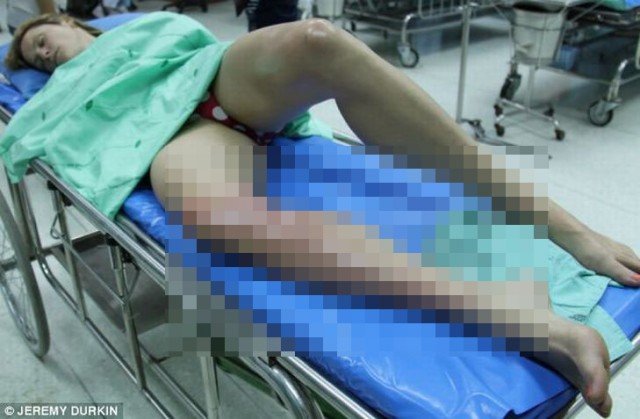 Покаталась на банане - повстречалась с медузой