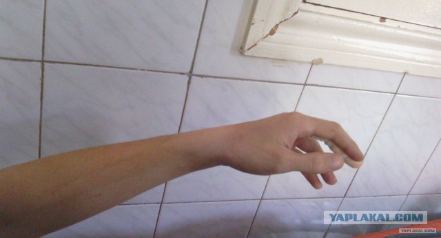 Упала сосулька на руку