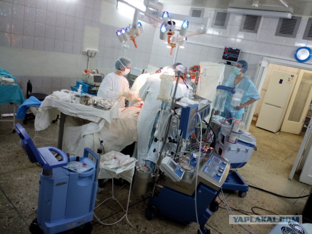 Искусственное кровообращение