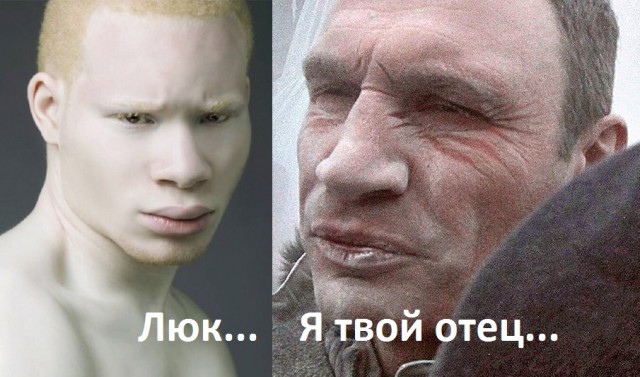 Как выглядят альбиносы разных рас?
