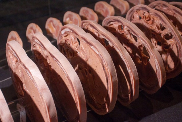 Анатомическая выставка в Москве