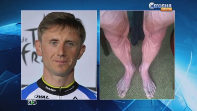 "Немного" устали:Ноги велогонщика после 16-го этапа «Тур де Франс»