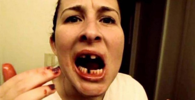 Житель Москвы 5 часов пытался снять кольцо со своего члена. Когда понял, что сам не справляется, то обратился к врачам