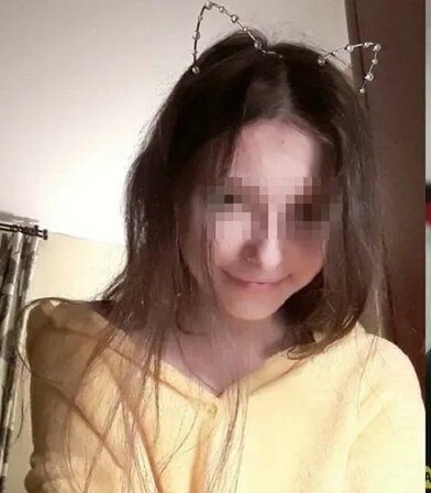 Облитой в Петербурге кислотой девушке ампутировали ухо