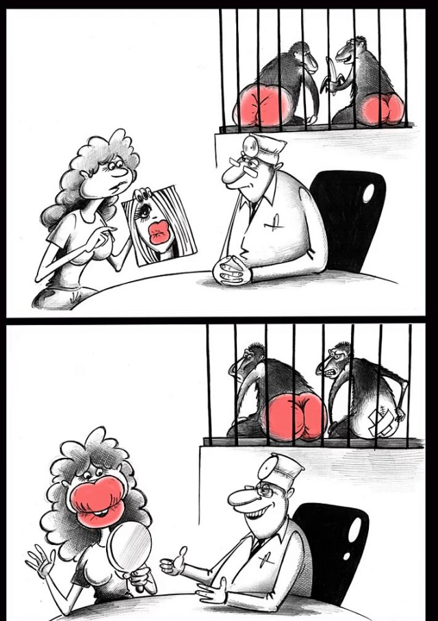 Ну и ну! Ей пришили ж@пу бабуина!