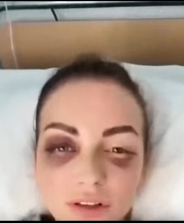 Мужчина отправил свою партнёршу в реанимацию из-за отказа заниматься сексом.