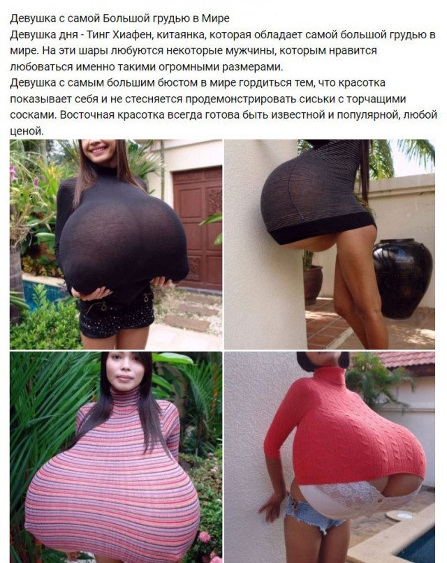 Губошлепка с самыми огромными губами захотела их еще больше увеличить