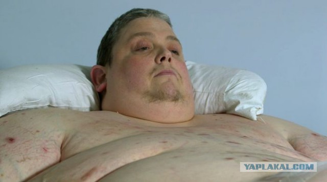 Рентгеновский снимок тела 400-кило-го мужчины