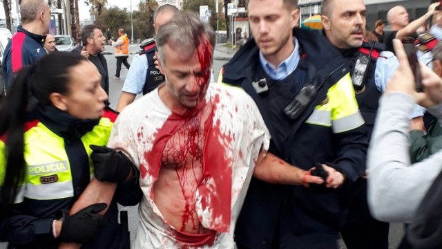 Суд назначил 5 000 рублей компенсации девушке, которой в полиции проломили кости лица