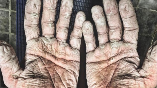 Вдогонку теме, которая в золоте