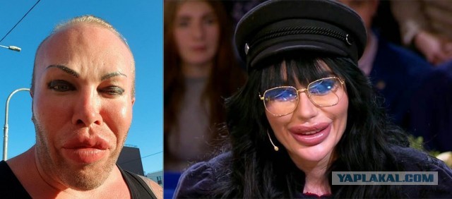 "Блохерша" с Урала испугала своими губами жениха