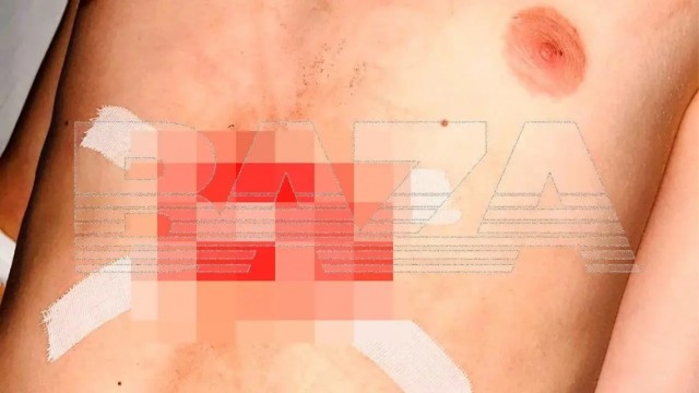 Вооружённый мужчина открыл стрельбу по подросткам в Подмосковье, крича «Крысы е**чие!»