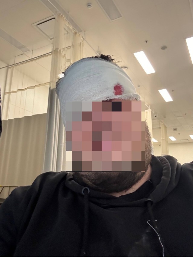 Кусок лепнины едва не убил пассажира в московском метро — мужчина получил тяжёлую травму головы.