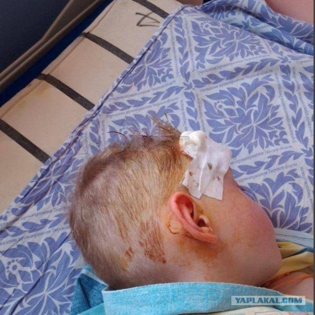 В Твери подрастающие абу-бандиты проломили голову 6-летнему мальчику