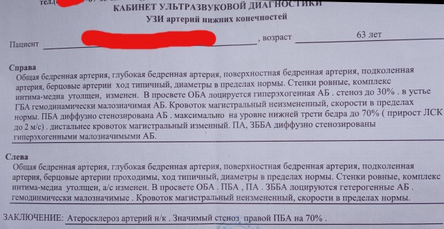 Атеросклероз н/к