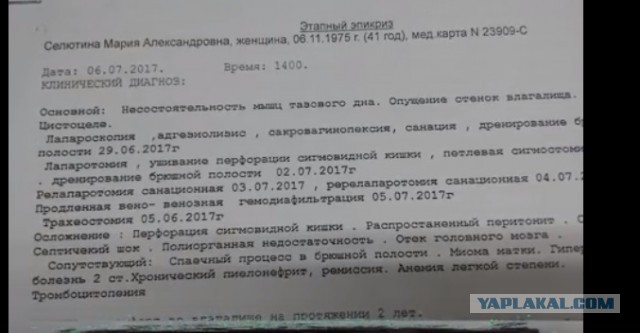 Москвичка погибла из-за прокола кишечника во время операции
