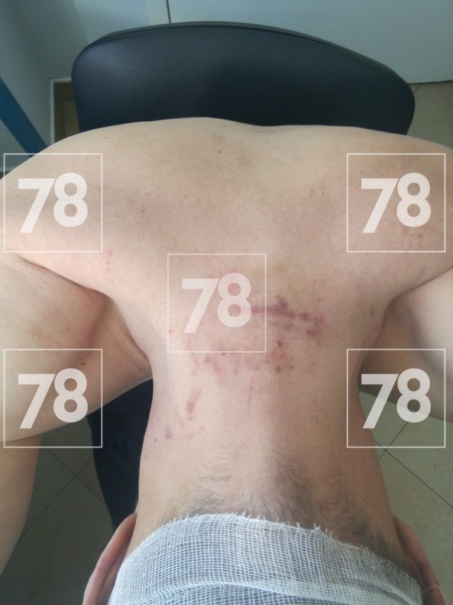 Трое приезжих избили мужчину, который заступился за девушку в Колпино