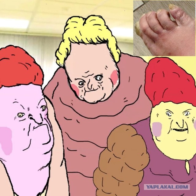 Укус гадюки