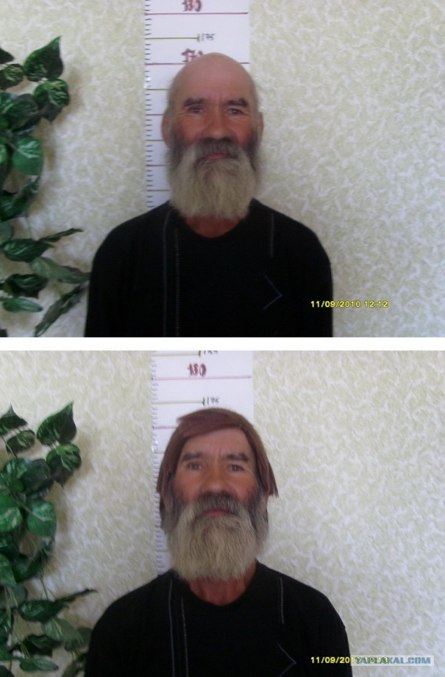 Как избавиться от лысины