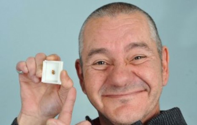 Самые неожиданные вещи, найденные в теле человека