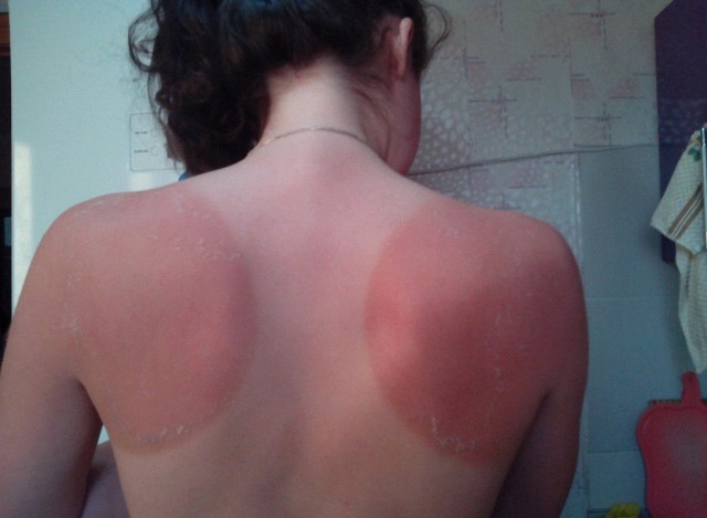 Так выглядит окученная картошка