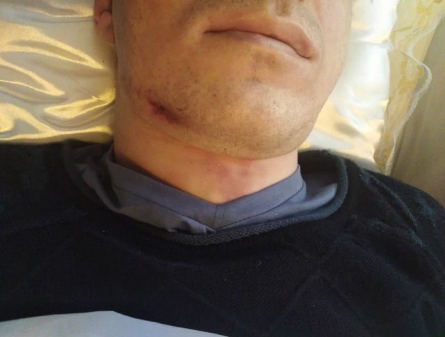 В полиции Петербурга умер 29-летний мужчина. На его теле остались гематомы и ссадины.
