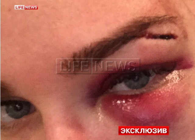 Девушку избили в ресторане, никто не вступился!