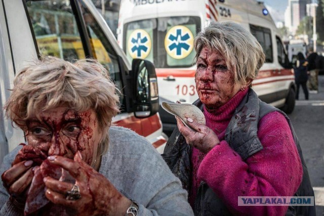 Фотосессия кровавых жертв в Киеве