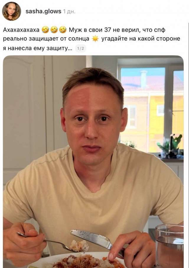 Парень не поверил, что спф реально спасает от солнца