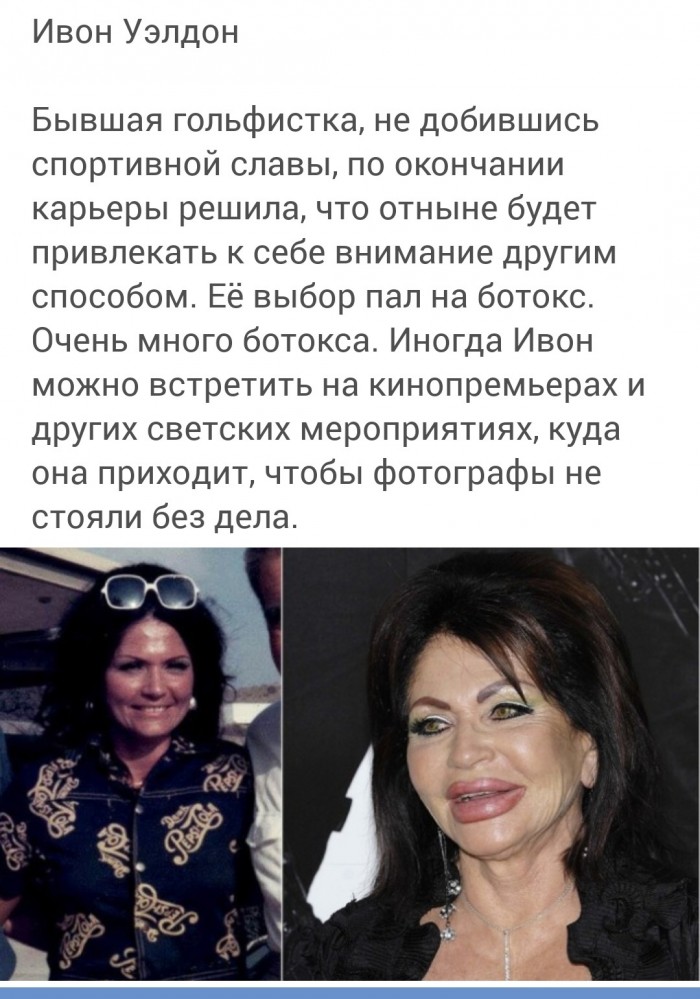 Обратная сторона пластической хирургии: фото до и после