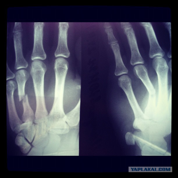 Одно неловкое движение