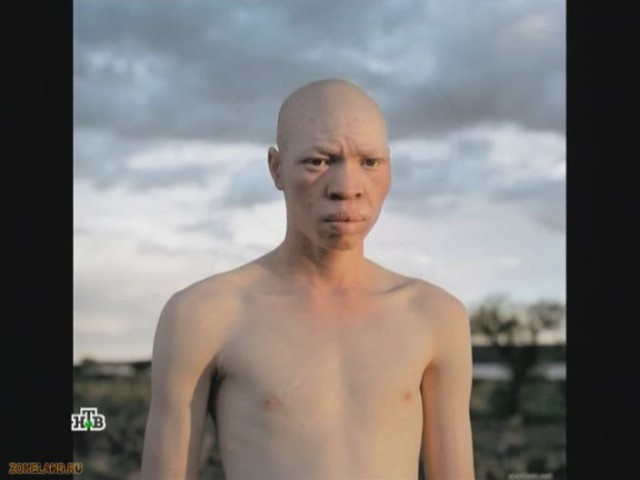Редкий набор генов