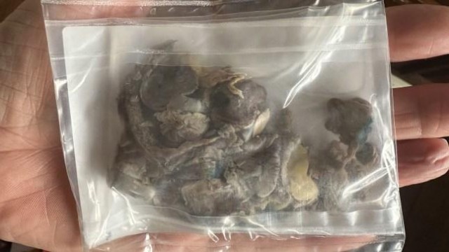 17-летнему подростку удалили почерневшее от вейпов лёгкое и вручили его в пакете